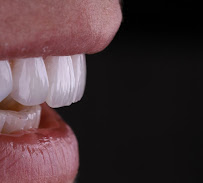 Smile Dental Center Medellín | Carillas Dentales y Diseño de Sonrisa