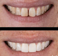 OrthoSquare Dental Clinic - Bandra West, Mumbai