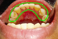 Dr. Joshi`s Tranquil Dental Care |Best dental treatment |Dentist near me |dental doctor |dental clinic|dentist in bandra east