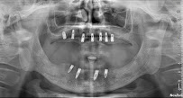 Dr Divakar Dhargalkar's Multispeciality Dental Clinic