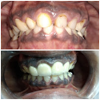 Exceldent Dental