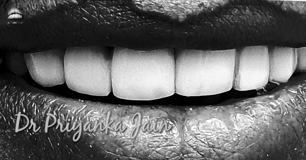 Smile Aura dental clinic in Mumbai