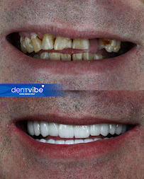 Dentvibe Dental Clinic