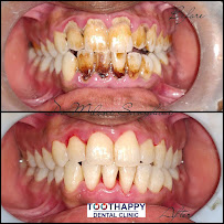 Toothappy Dental Clinic - Dr Miloni Sanghavi