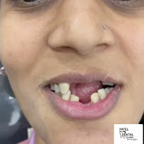 Patel Dental Clinic Andheri