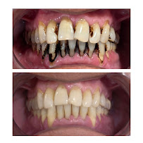 Shining Smiles Dental Clinic