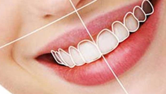 Laser Dental Clinic dental clinic