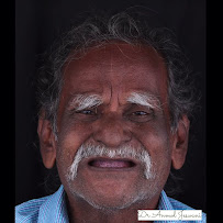 Smilo Dental Clinic - Dentist in Lokhandwala Andheri West