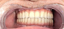 Shroff's Multi-Speciality Dental Clinic