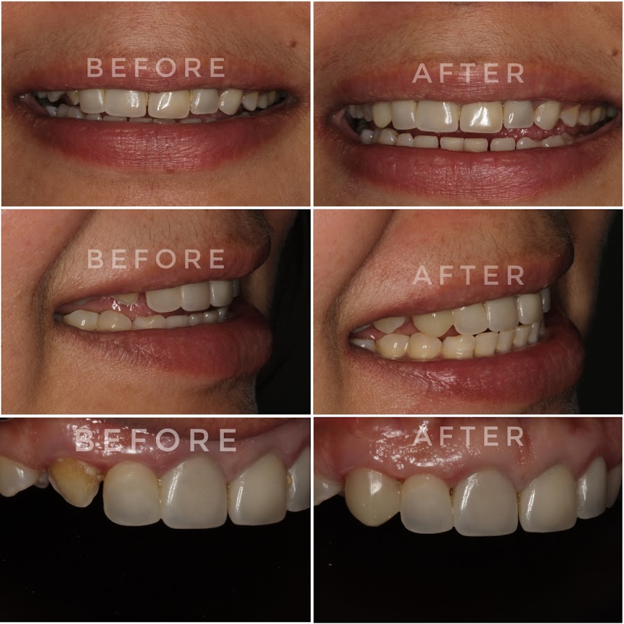 Dento-32 Multispeciality Dental Clinic dental clinic in Mumbai