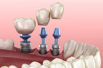 Dentsure Dental Clinic
