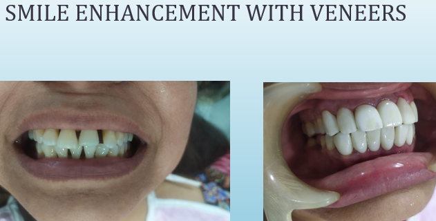 Dr. Pankti Shah's Dental Clinic dental clinic