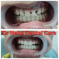Dr Neha Dental Care