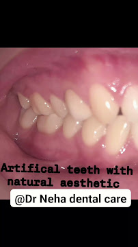 Dr Neha Dental Care