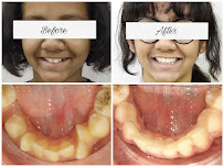 Smile Plus Dental Clinic and Orthodontic Centre