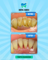 Dental Diaries