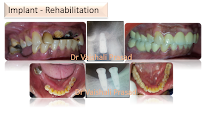 Dr Vaishali Prasad - General, Pediatric & Implant Dentist