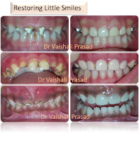 Dr Vaishali Prasad - General, Pediatric & Implant Dentist
