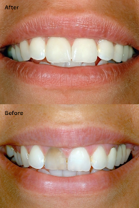 Calm Dentistry Dental Clinic | Dr. Raksha Shetty | Dentist