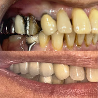 Calm Dentistry Dental Clinic | Dr. Raksha Shetty | Dentist