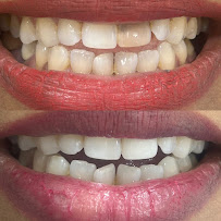 Calm Dentistry Dental Clinic | Dr. Raksha Shetty | Dentist