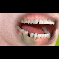 Thane Seva Dental