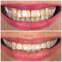 Orthosquare