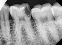 Om Dental Clinic Dr. Hemangi Ruparel