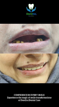 DentInc. Dental Care