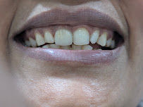 Aditi Dental Care