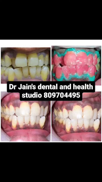 Dr. Jain's Dental & Health Studio