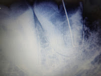 Just Smile Dental Clinic and Implant Centre