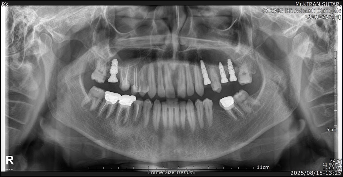 Allure Dental Care and Implant Centre dental clinic in Mumbai