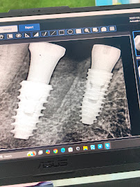 Allure Dental Care and Implant Centre