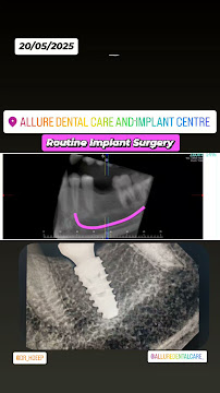 Allure Dental Care and Implant Centre