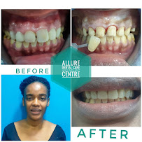 Allure Dental Care and Implant Centre