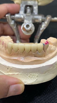 Dr Vinothini Smilekraft Dental Clinic