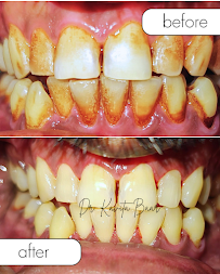Dentaire Smile Clinic Seawoods Navi Mumbai