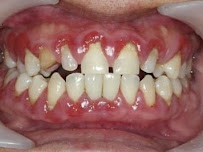 Aledentz Dental & Medical Center Delhi NCR