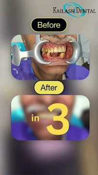 Kailash Dental (on Panel CGHS,DGEHS,MCD,DJB,ICAR)