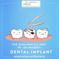 Advanced Dental & Root Canal Treatment Centre (Dr Sanjay Agarwal & Dr Priti Agarwal)