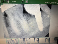 Shah Dental Clinic - Dentist in Green Park I Dentist in Delhi I Dental impalnts & RCT Treatment I Teeth whitening
