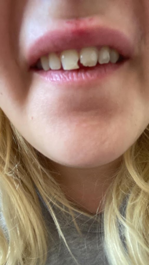 Novexdent - Best Dental Clinic in Turkey