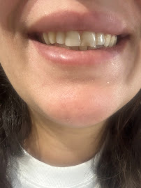 Novexdent - Best Dental Clinic in Turkey