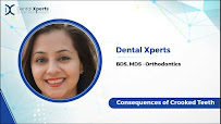 Dental Xperts | Dental Clinic, Dental Implants, Root Canal Treatment, Aligners | South Extension II, Delhi