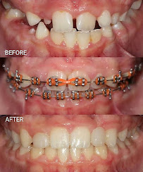 Maurya Dental Clinic in Saket South Delhi