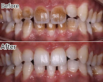 Maurya Dental Clinic in Saket South Delhi