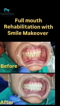 Maximus Dental Care