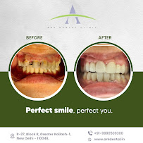 Ark Dental Clinic - Greater Kailash, South Delhi