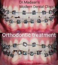 Dr. Madaan - Best Dentist in Gurgaon, RCT, Implant Specialist, Dental Clinic